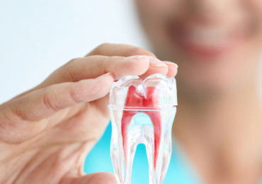 Root-Canal-Treatment-370x260
