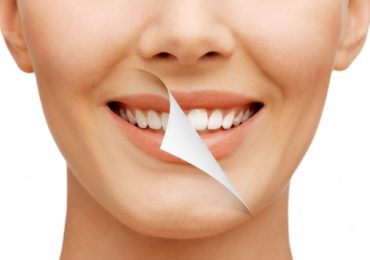 new-smile-min-925x425-1